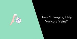 Does Massaging Help Varicose Veins